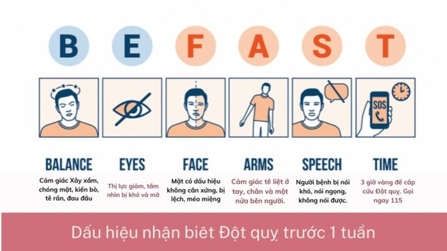 Quy tắc BEFAST giúp nhận biết nhanh nhồi máu não và xử trí kịp thời Quy tắc BEFAST giúp nhận biết nhanh nhồi máu não và xử trí kịp thời