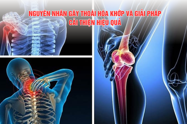 Nguyên nhân gây thoái hóa khớp và giải pháp hỗ trợ cải thiện hiệu quả
