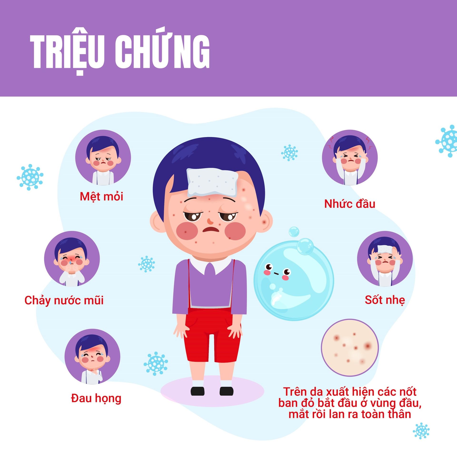 Bệnh thủy đậu và những điều cần biết