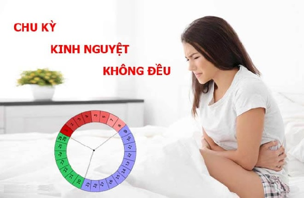 Kinh nguyệt không đều ảnh hưởng rất lớn đến cuộc sống của người bệnh Kinh nguyệt không đều ảnh hưởng rất lớn đến cuộc sống của người bệnh