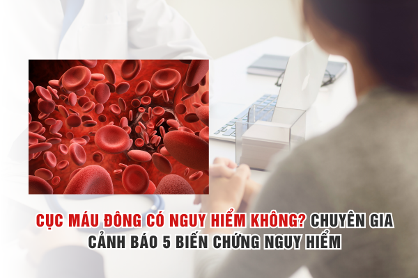 Cục máu đông có nguy hiểm không? Chuyên gia cảnh báo 5 biến chứng nguy hiểm