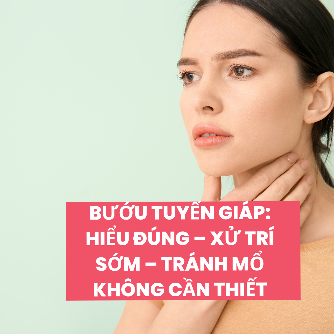 Bướu tuyến giáp: Hiểu đúng – Xử trí sớm – Tránh mổ không cần thiết