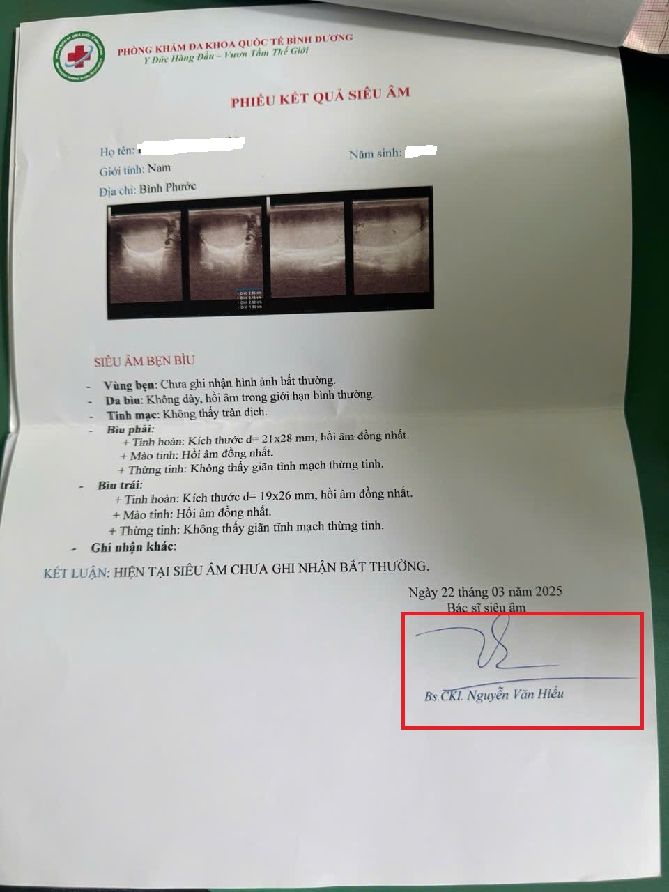 Bác sĩ siêu âm là nữ nhưng trên kết quả siêu âm ký là bác sĩ nam Bác sĩ siêu âm là nữ nhưng trên kết quả siêu âm ký là bác sĩ nam