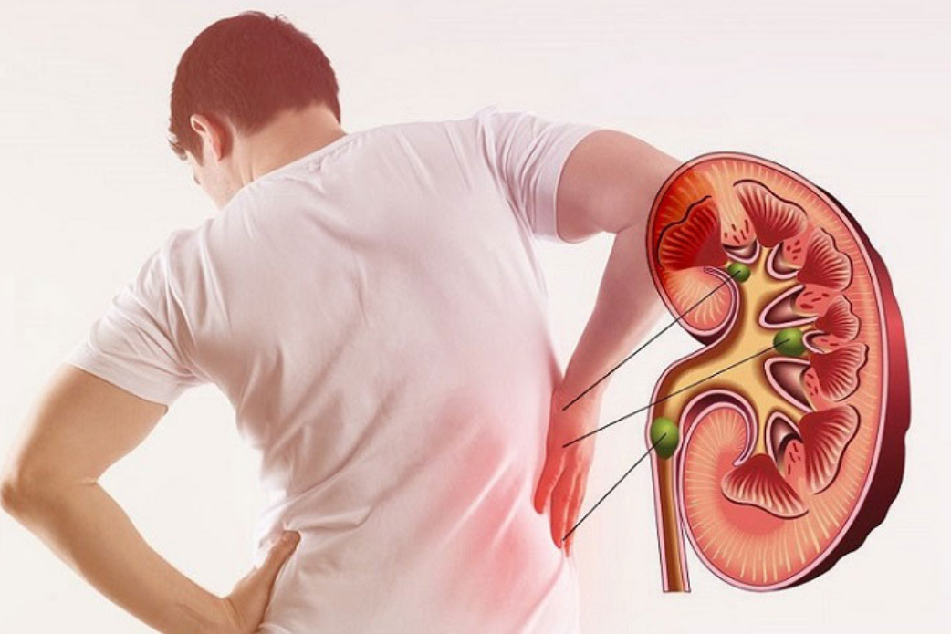 Vì sao giới trẻ ngày càng dễ suy thận? Cảnh báo từ những thói quen thường ngày