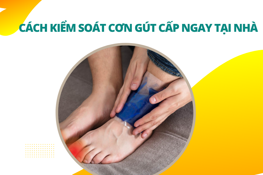 5 cách kiểm soát cơn gút cấp ngay tại nhà không dùng thuốc