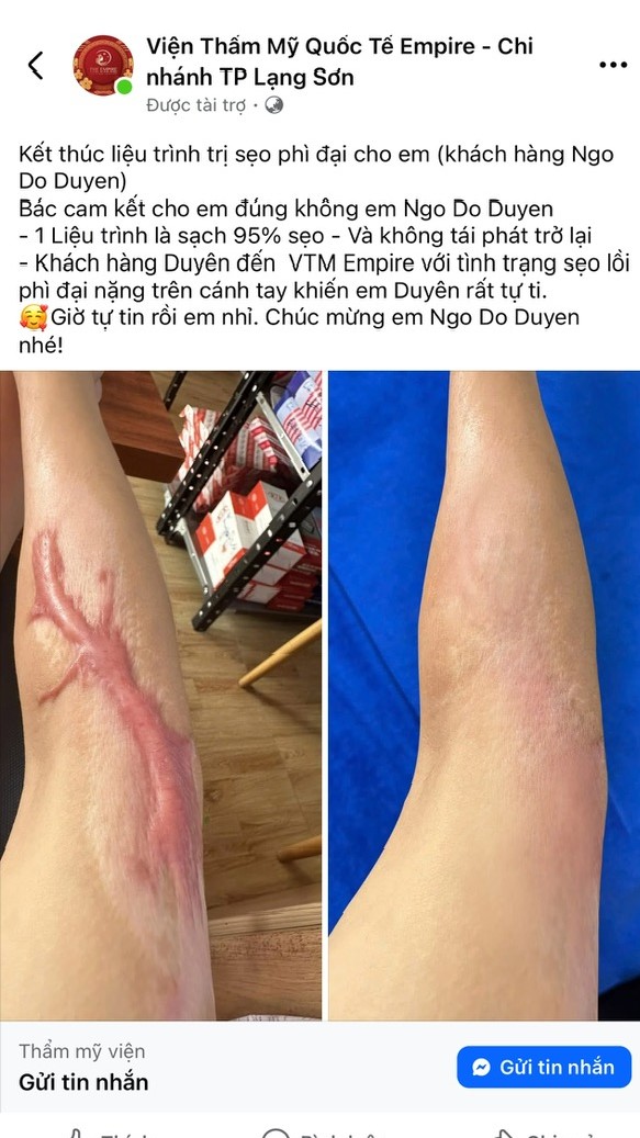 Nhiều khách hàng bức xúc Viện thẩm mỹ Emprie Lạng Sơn (Viện sắc đẹp Emprie)
