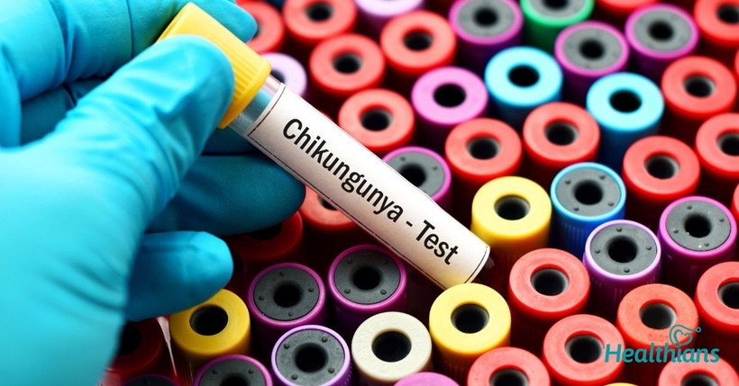 Đợt bùng phát virus Chikungunya đã bắt đầu từ đầu năm nay. Đợt bùng phát virus Chikungunya đã bắt đầu từ đầu năm nay.