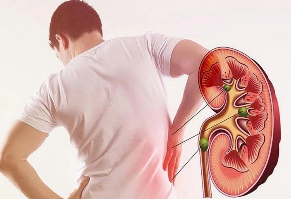 5 dấu hiệu bất thường ở tay phản ánh thận đang suy yếu