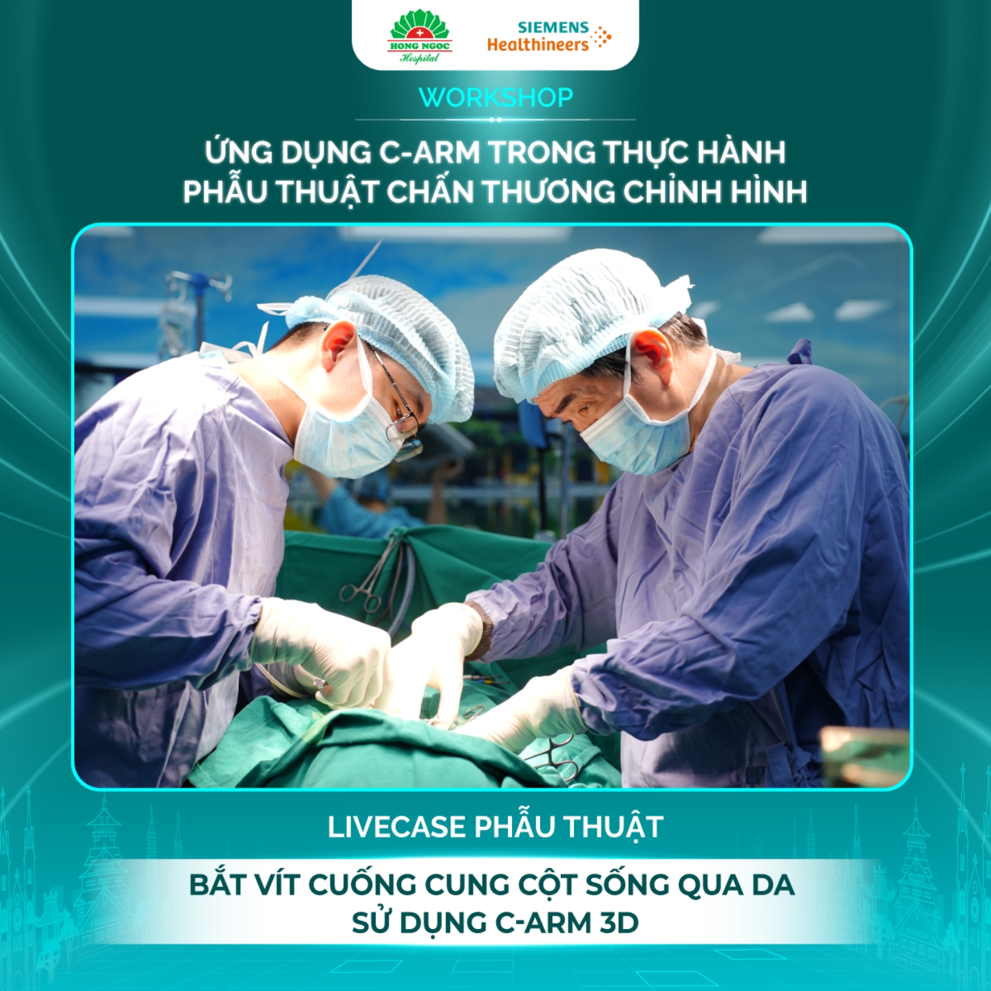 Tường thuật trực tiếp ca phẫu thuật cột sống với kỹ thuật “Bắt vít cuống cung cột sống qua da sử dụng C-arm 3D”. Tường thuật trực tiếp ca phẫu thuật cột sống với kỹ thuật “Bắt vít cuống cung cột sống qua da sử dụng C-arm 3D”.