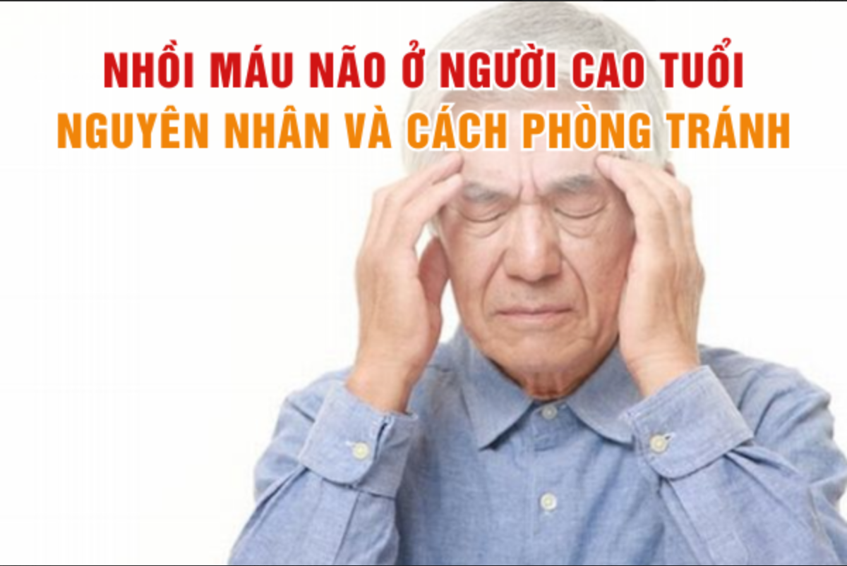 Nhồi máu não ở người cao tuổi: Nguyên nhân và cách phòng tránh