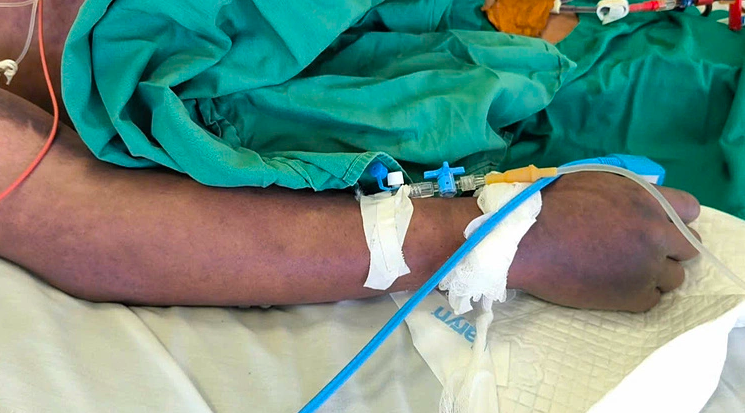 Bệnh liên cầu lợn xuất hiện tại Hà Nội, nhiều dịch bệnh khác có xu hướng gia tăng