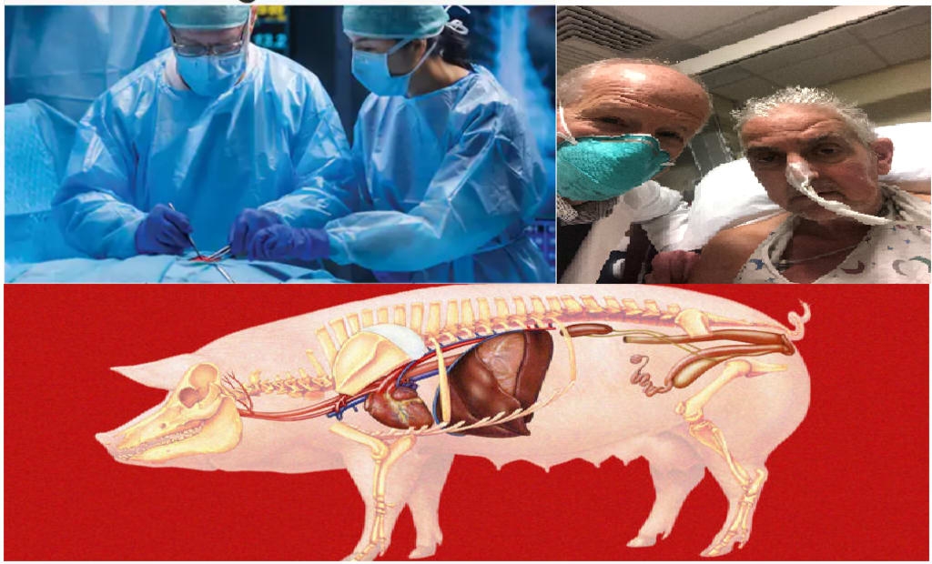 Y học đột phá: Cấy ghép phổi lợn thành công