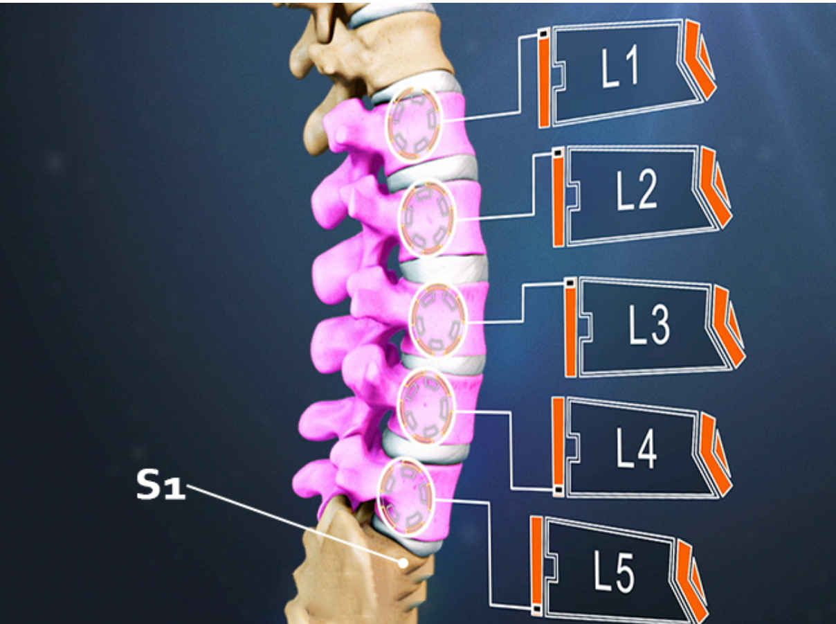 Thoát vị đĩa đệm L2 L3 ngày càng có nhiều người mắc Thoát vị đĩa đệm L2 L3 ngày càng có nhiều người mắc