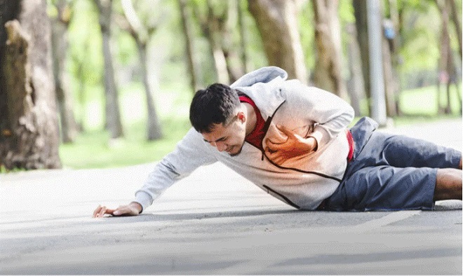 Báo động đột quỵ khi chơi thể thao: Vì sao lại xảy ra và cách phòng tránh?