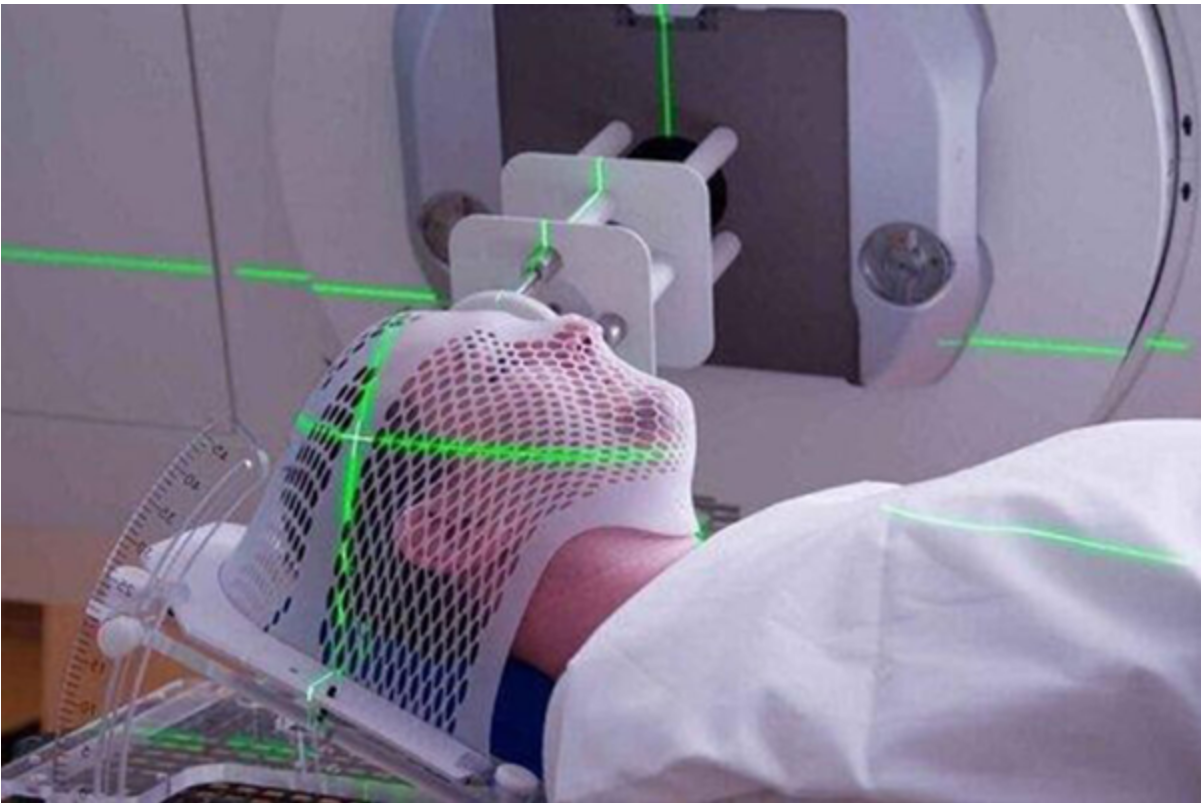 Thảo dược hỗ trợ giảm tác dụng phụ, tăng cường hiệu quả hóa trị, xạ trị trong điều trị khối u