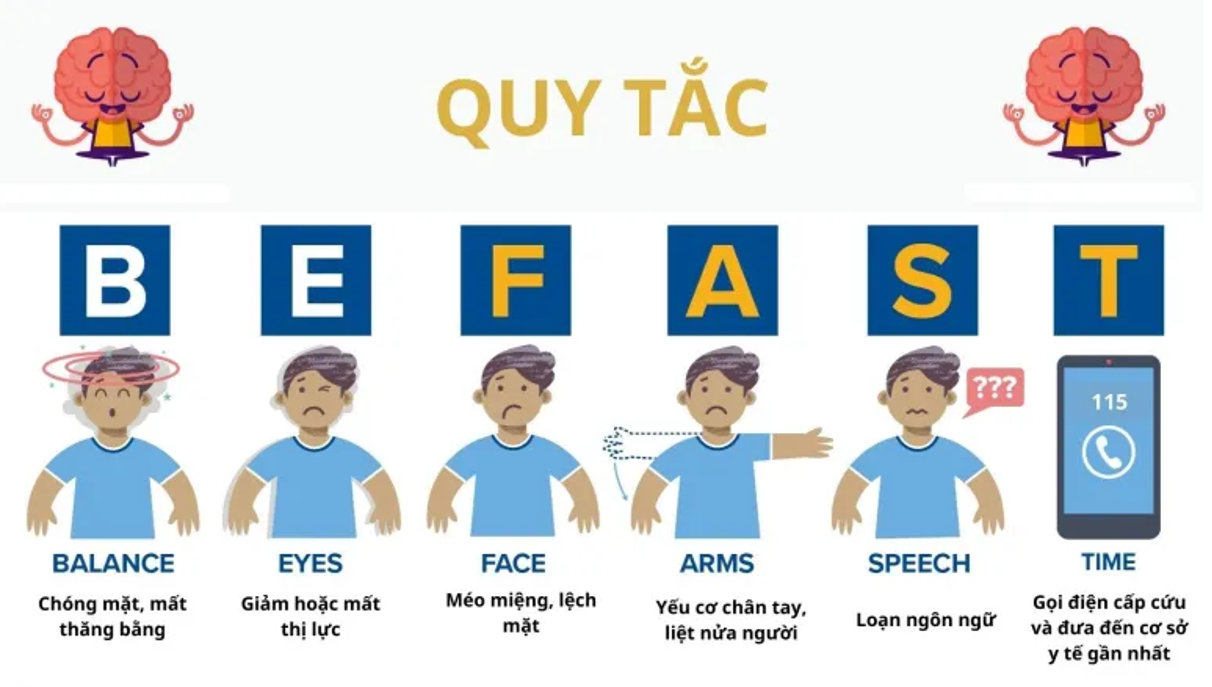 BEFAST là phương pháp giúp nhận biết dấu hiệu của tai biến mạch máu não
