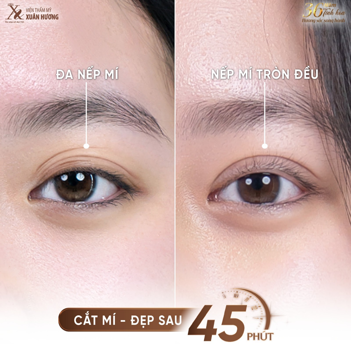 Khắc phục các khuyết điểm che mờ vẻ đẹp đôi mắt. Tạo hình thẩm mỹ, đem lại thần thái hoàn hảo cho đôi mắt