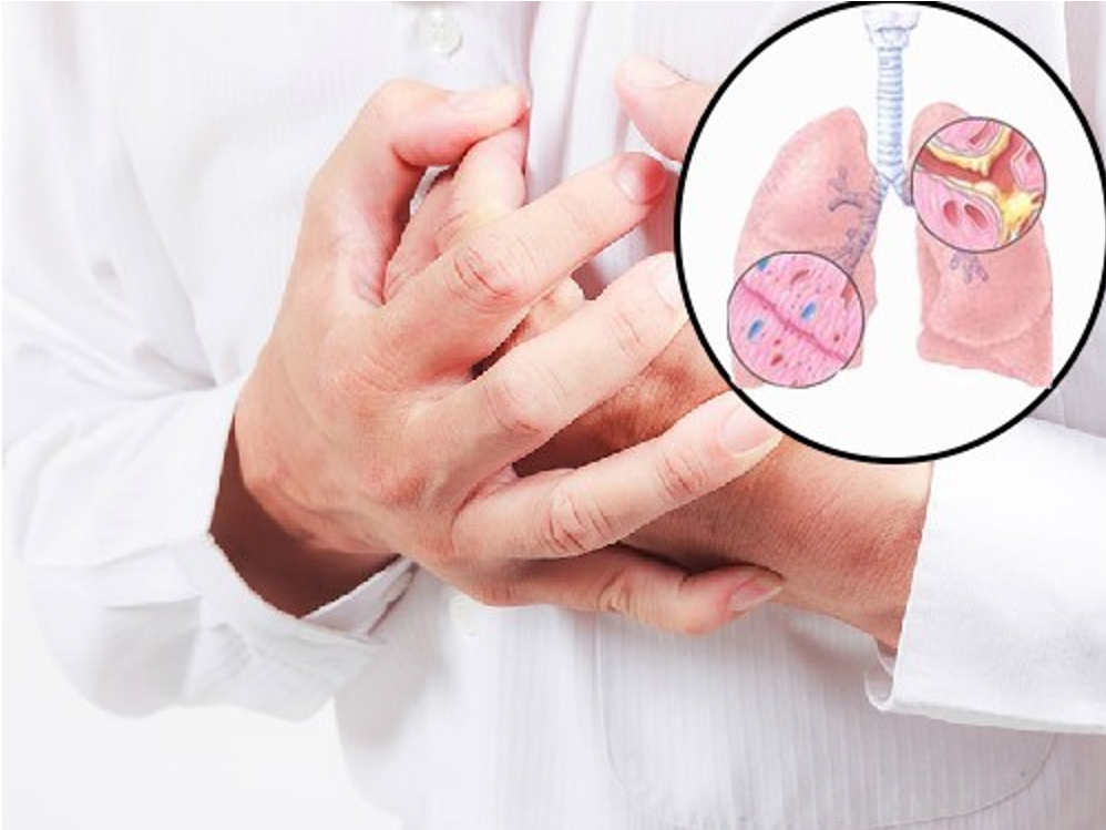 Viêm phế quản mạn tính thường diễn tiến âm thầm