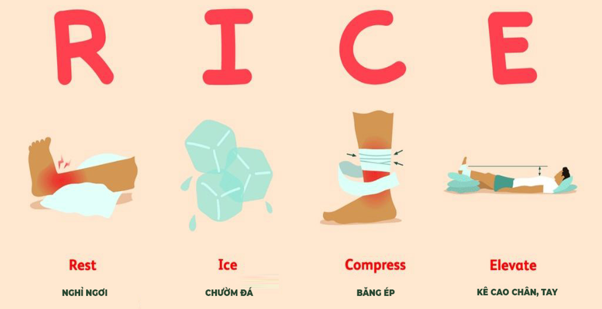 Liệu pháp RICE là biện pháp đơn giản giúp giảm đau mỏi khớp tại nhà