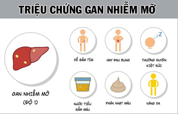 8 nhóm người có nguy cơ cao mắc bệnh gan nhiễm mỡ: Những dấu hiệu cảnh báo không thể bỏ qua