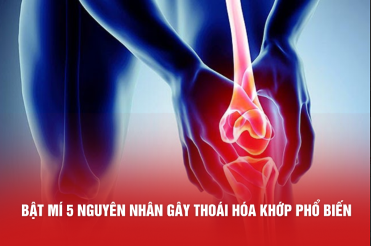 Bật mí 5 nguyên nhân gây thoái hóa khớp phổ biến. Đừng bỏ lỡ!