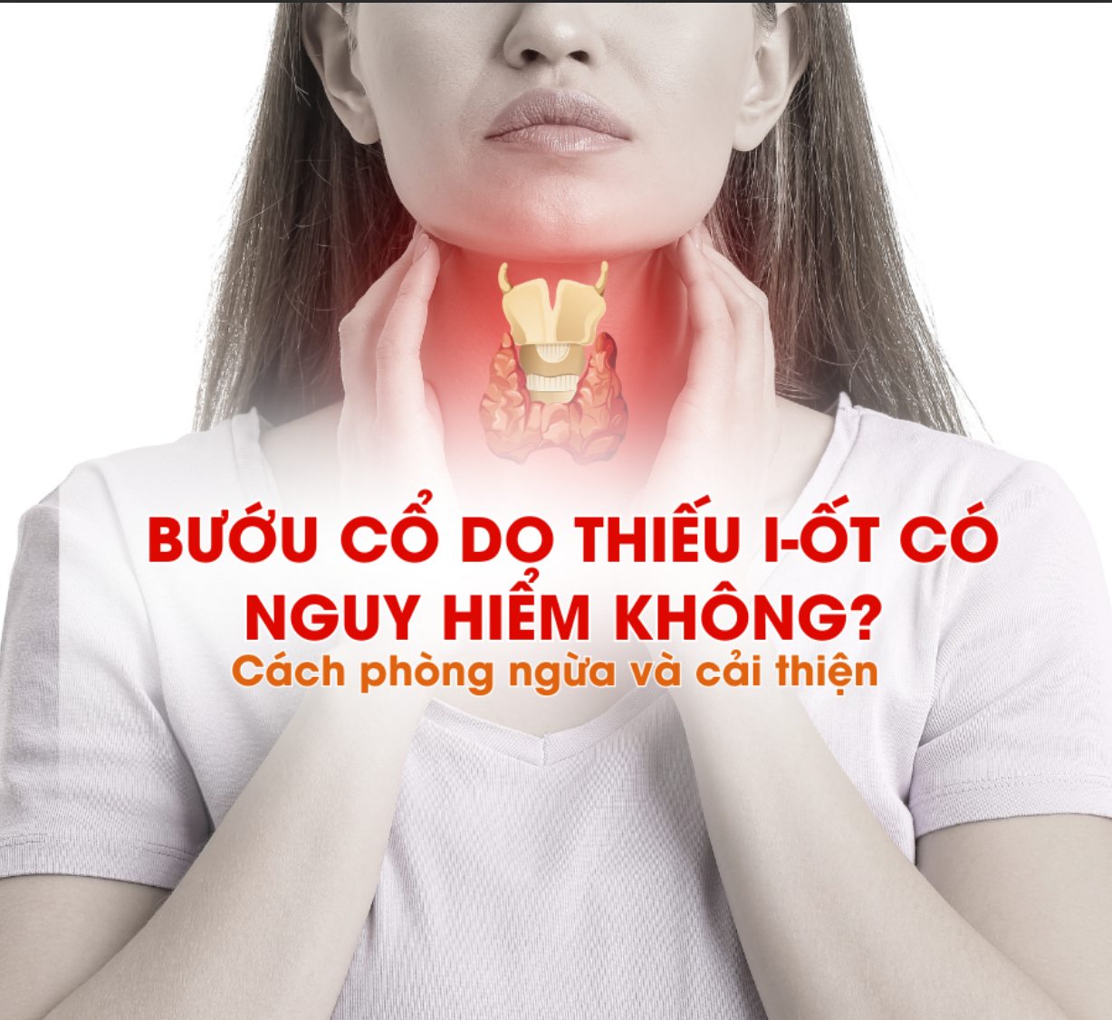 Bướu cổ do thiếu i-ốt có nguy hiểm không? Cách phòng ngừa và cải thiện
