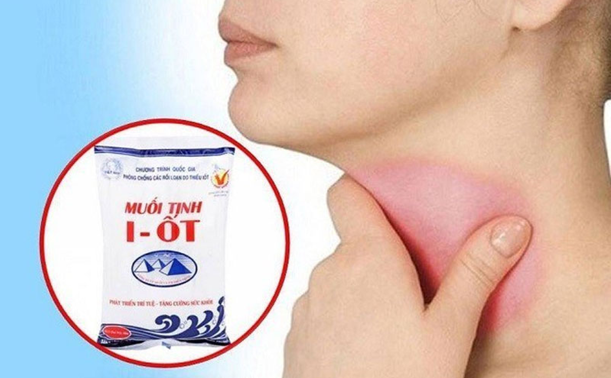 Thiếu i-ốt là nguyên nhân chính gây bướu cổ
