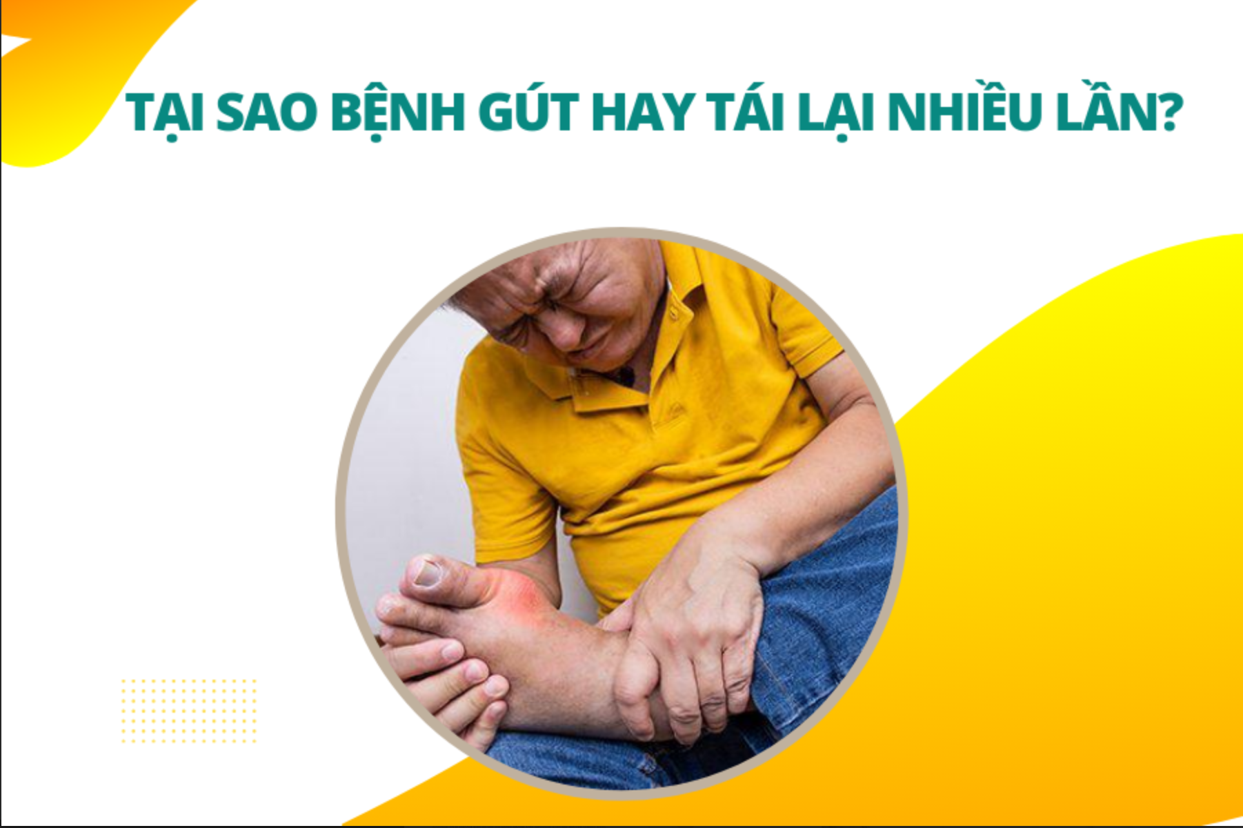 Tại sao bệnh gút hay tái lại nhiều lần?