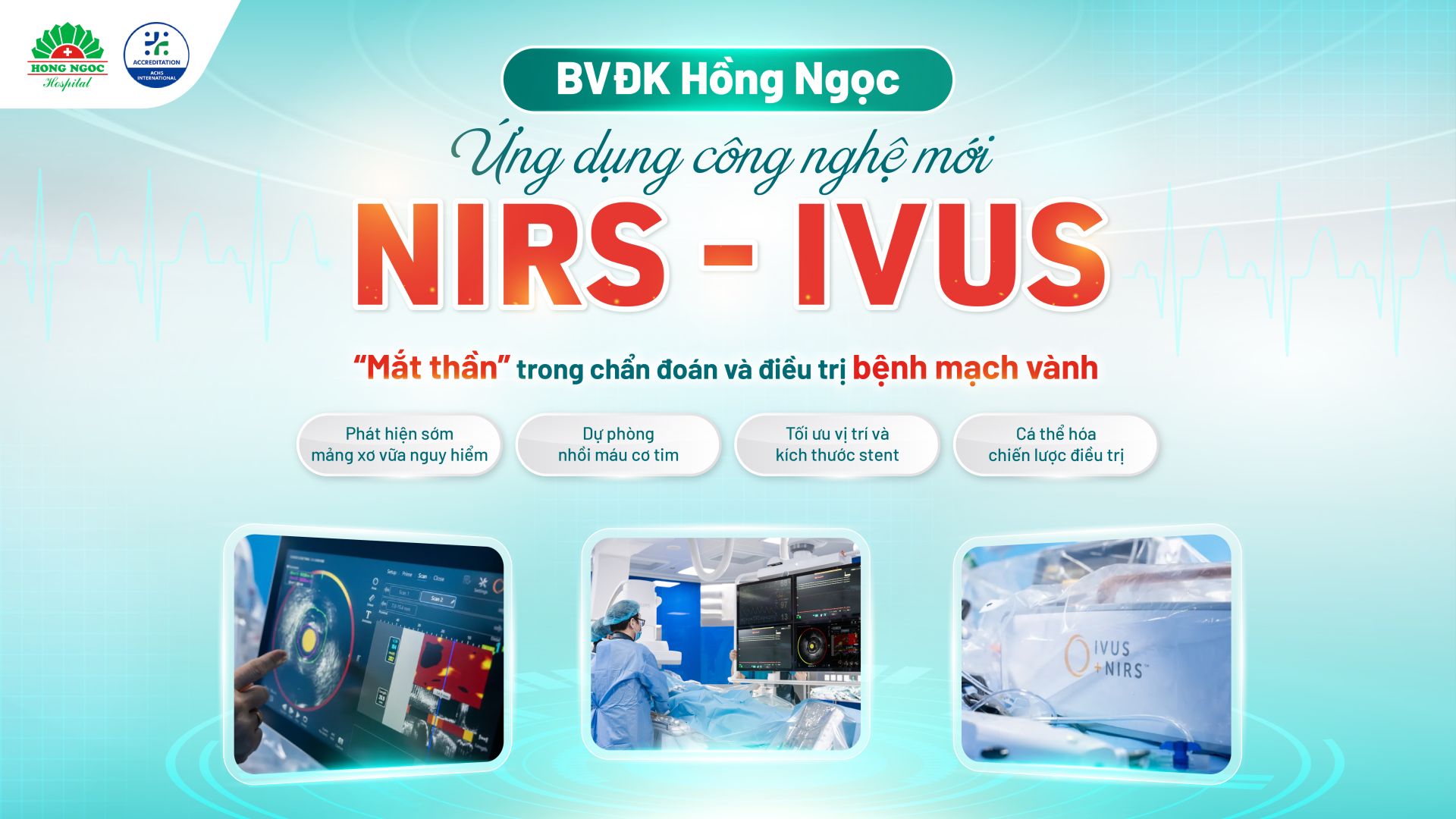 Công nghệ NIRS-IVUS giúp bác sĩ “nhìn thấu” cấu trúc và thành phần mảng xơ vữa, nâng cao hiệu quả điều trị bệnh lý tim mạch Công nghệ NIRS-IVUS giúp bác sĩ “nhìn thấu” cấu trúc và thành phần mảng xơ vữa, nâng cao hiệu quả điều trị bệnh lý tim mạch