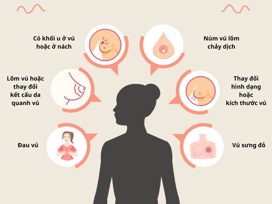 Không chỉ là khối u: 5 dấu hiệu sớm của ung thư vú dễ bị nhầm lẫn và bỏ qua