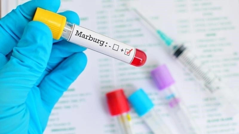 Virus Marburg cực kỳ nguy hiểm, gây chết người bùng phát tại Ethiopia