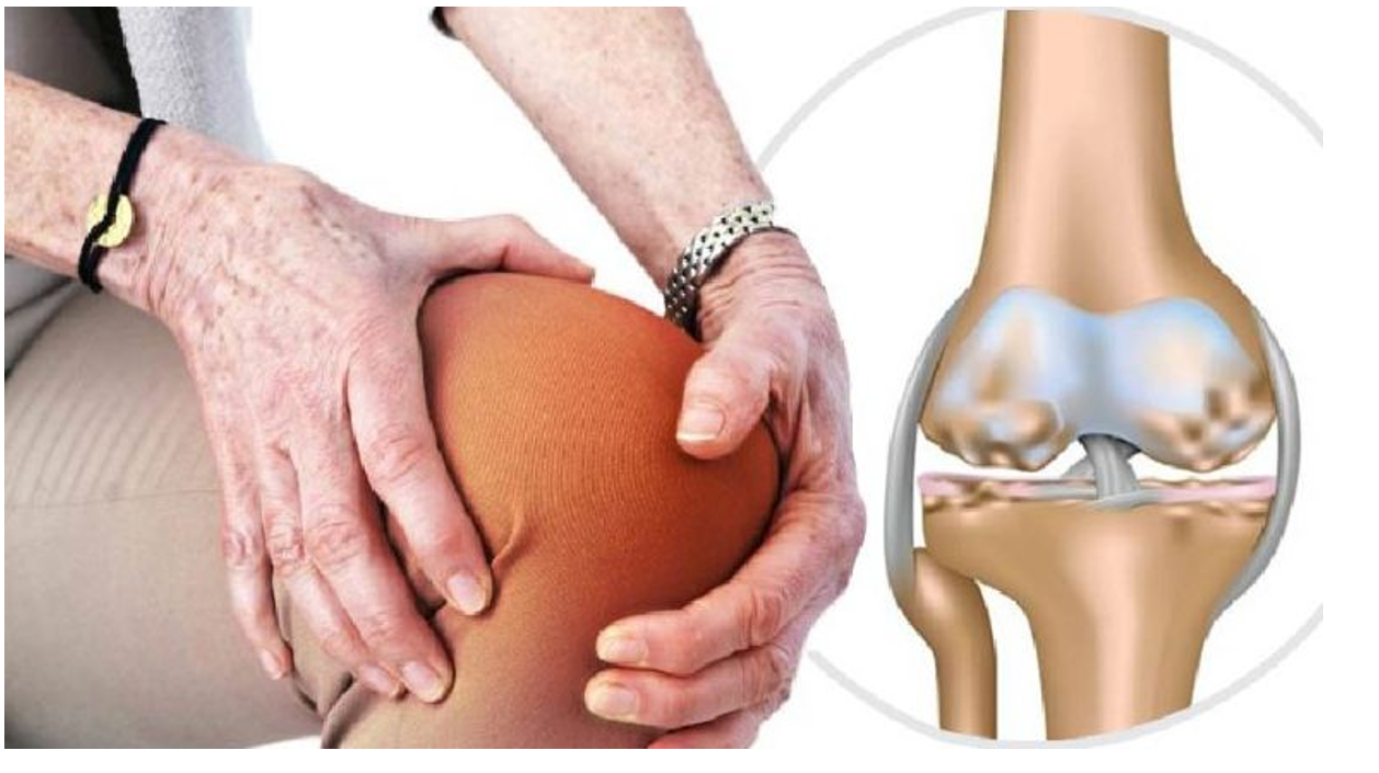Thiếu dưỡng chất khiến sụn khớp suy yếu, dễ gây ra thoái hóa khớp