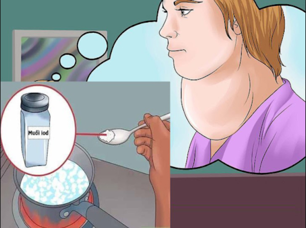 6 cách cải thiện bướu tuyến giáp an toàn và hiệu quả