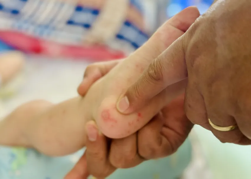 Theo Bộ Y tế, hiện nay thời tiết đang trong giai đoạn chuyển mùa Thu - Đông, sự thay đổi thất thường của nhiệt độ và độ ẩm là điều kiện thuận lợi cho các tác nhân gây bệnh đường hô hấp, tiêu hóa phát triển và lây lan