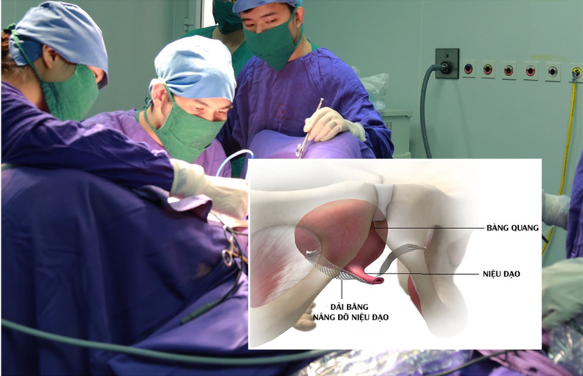 Phẫu thuật điều trị tiểu són được chỉ định khi cần