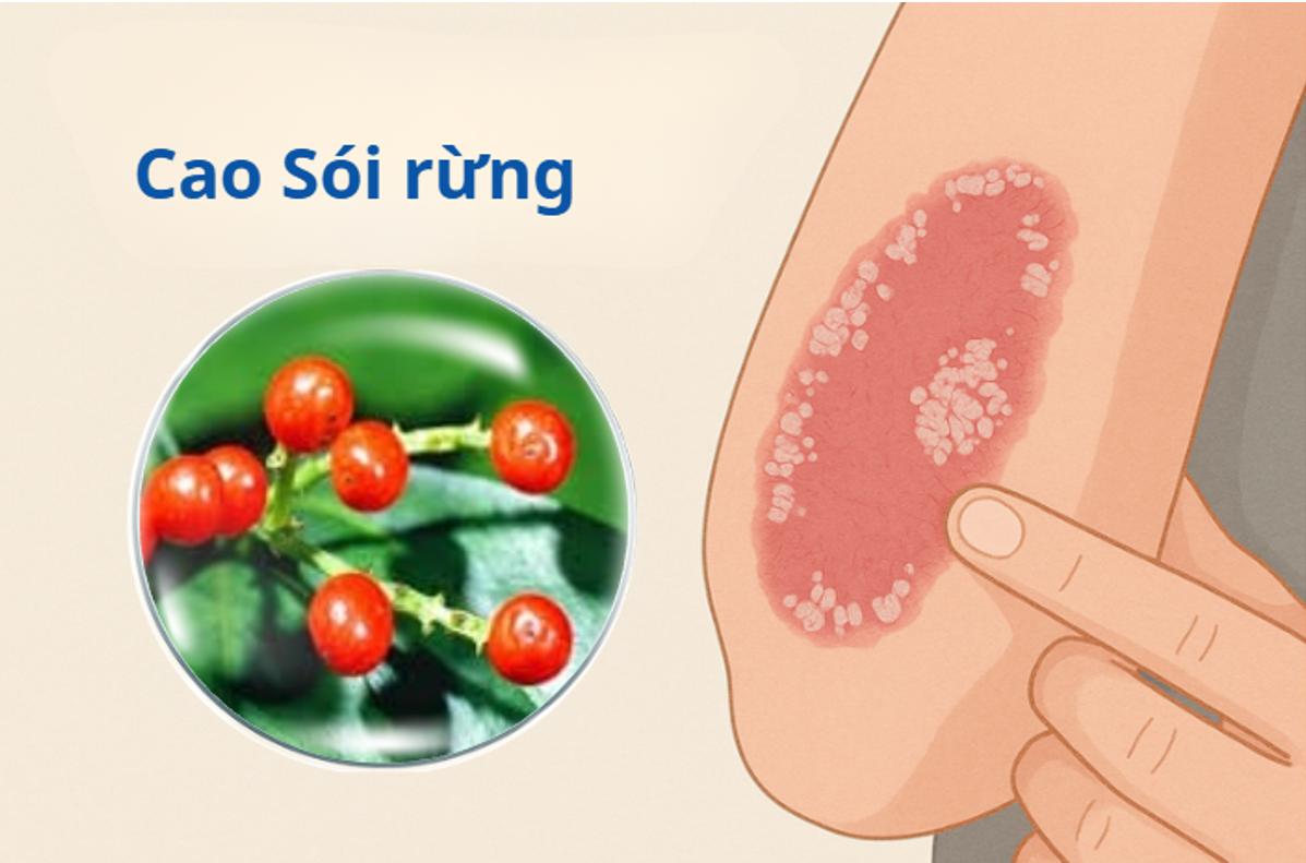 Sói rừng đã được chứng minh có khả năng giúp hệ miễn dịch - hệ thống an ninh 24/7 của cơ thể hoạt động tốt hơn Sói rừng đã được chứng minh có khả năng giúp hệ miễn dịch - hệ thống an ninh 24/7 của cơ thể hoạt động tốt hơn