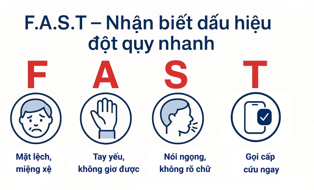 Quy tắc FAST giúp dễ dàng nhận biết dấu hiệu sớm của tai biến mạch máu não Quy tắc FAST giúp dễ dàng nhận biết dấu hiệu sớm của tai biến mạch máu não