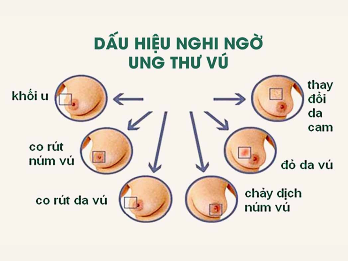 Bước tiến mới trong điều trị ung thư vú tối ưu hóa thời gian và nâng cao chất lượng sống