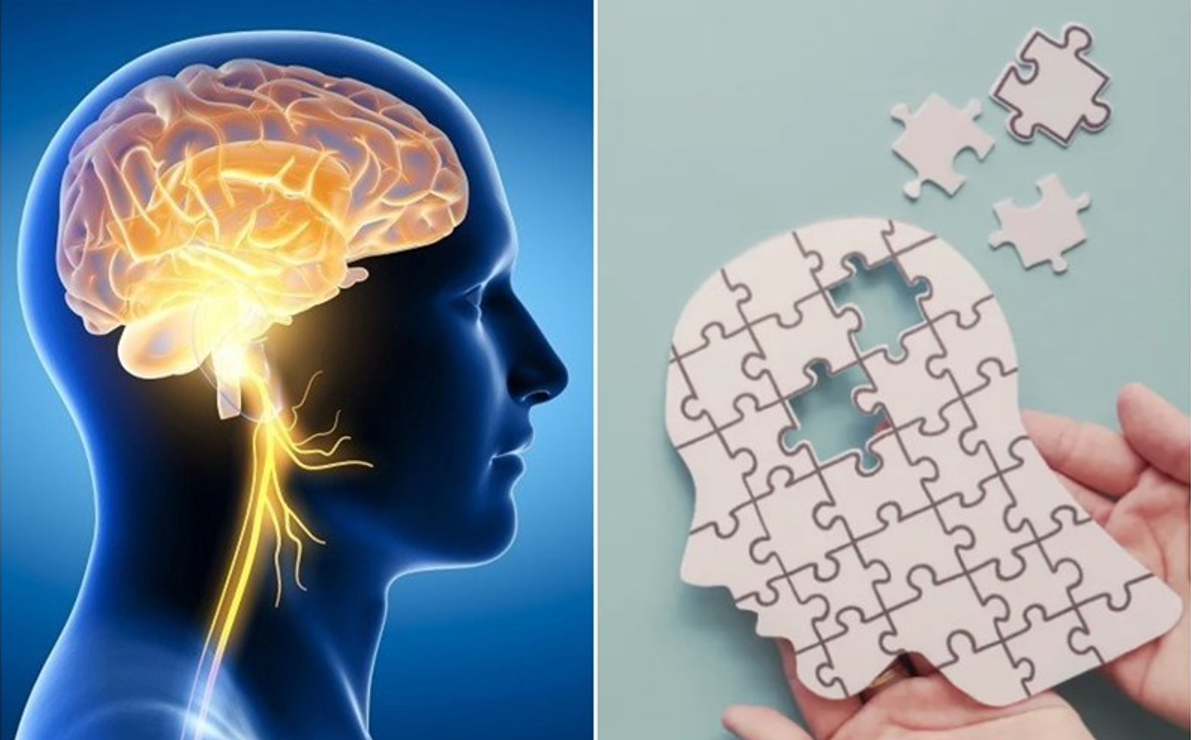 Não bộ gặp vấn đề khi truyền tải thông tin có thể gây suy giảm chức năng não bộ Não bộ gặp vấn đề khi truyền tải thông tin có thể gây suy giảm chức năng não bộ