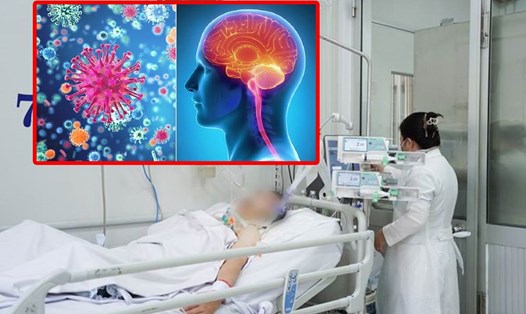 Cảnh báo sự trở lại của bệnh não mô cầu xâm lấn với nguy cơ tử vong nhanh trong 24 giờ