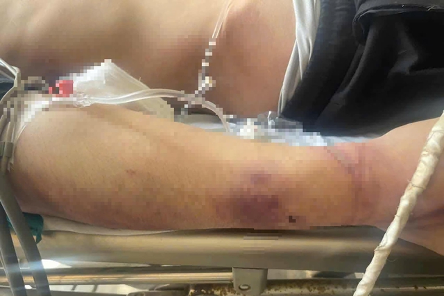 Quảng Ninh: Đình chỉ Trung tâm Công tác xã hội Hải Hà vụ học viên tử vong sau 2 ngày đi học