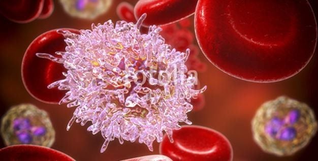 Phát hiện biến thể gene hiếm giúp giảm nguy cơ ung thư máu