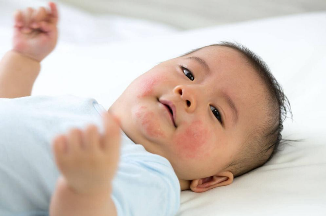 Cha mẹ cần giữ da b&eacute; sạch nhưng kh&ocirc;ng l&agrave;m mất đi độ ẩm tự nhi&ecirc;n