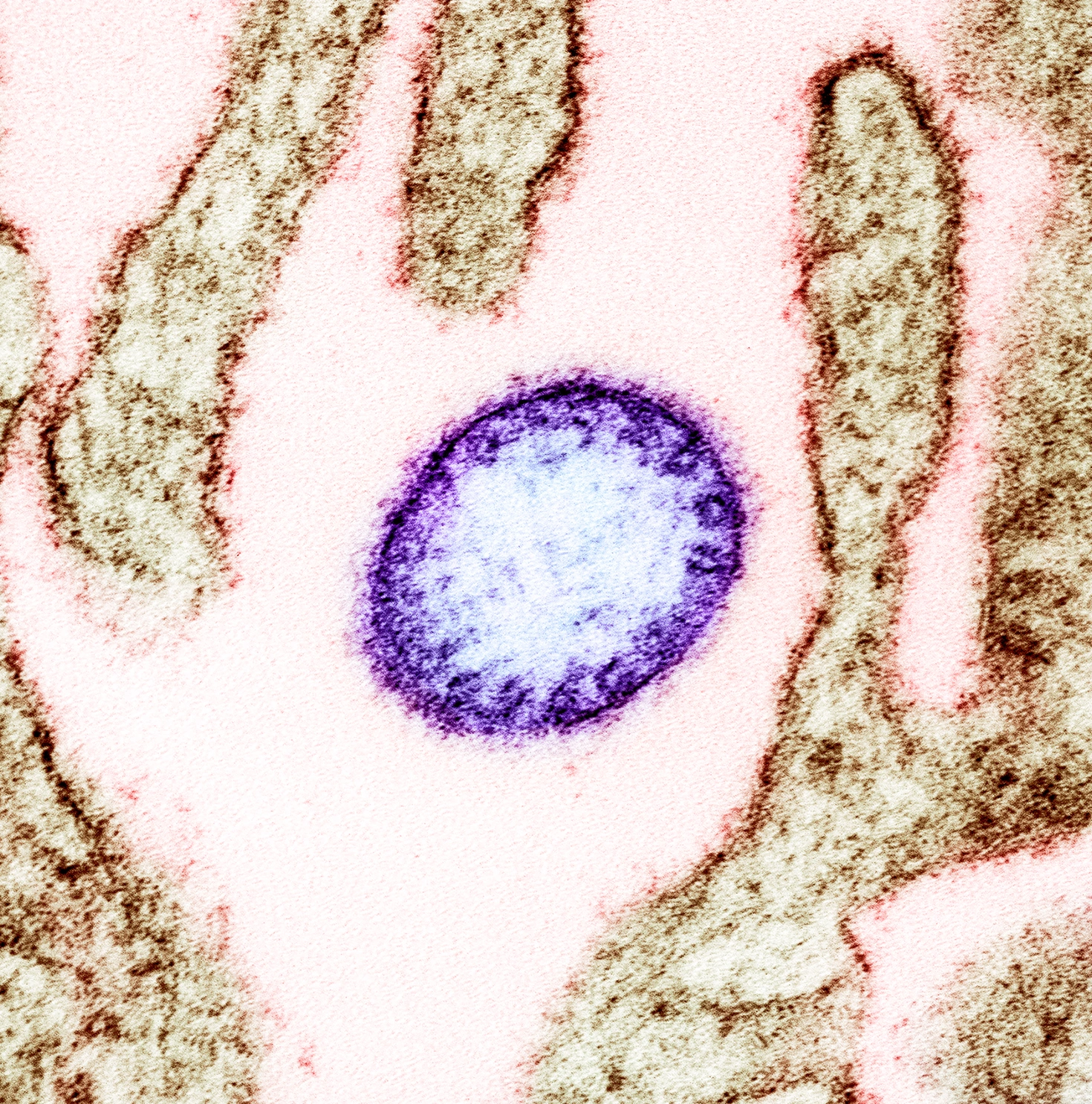 Hình ảnh dưới kính hiển vi điện tử cho thấy virus Nipah (được tô màu tím) nằm bên cạnh một tế bào Vero (màu nâu) (Ảnh: NIAID). Hình ảnh dưới kính hiển vi điện tử cho thấy virus Nipah (được tô màu tím) nằm bên cạnh một tế bào Vero (màu nâu) (Ảnh: NIAID).