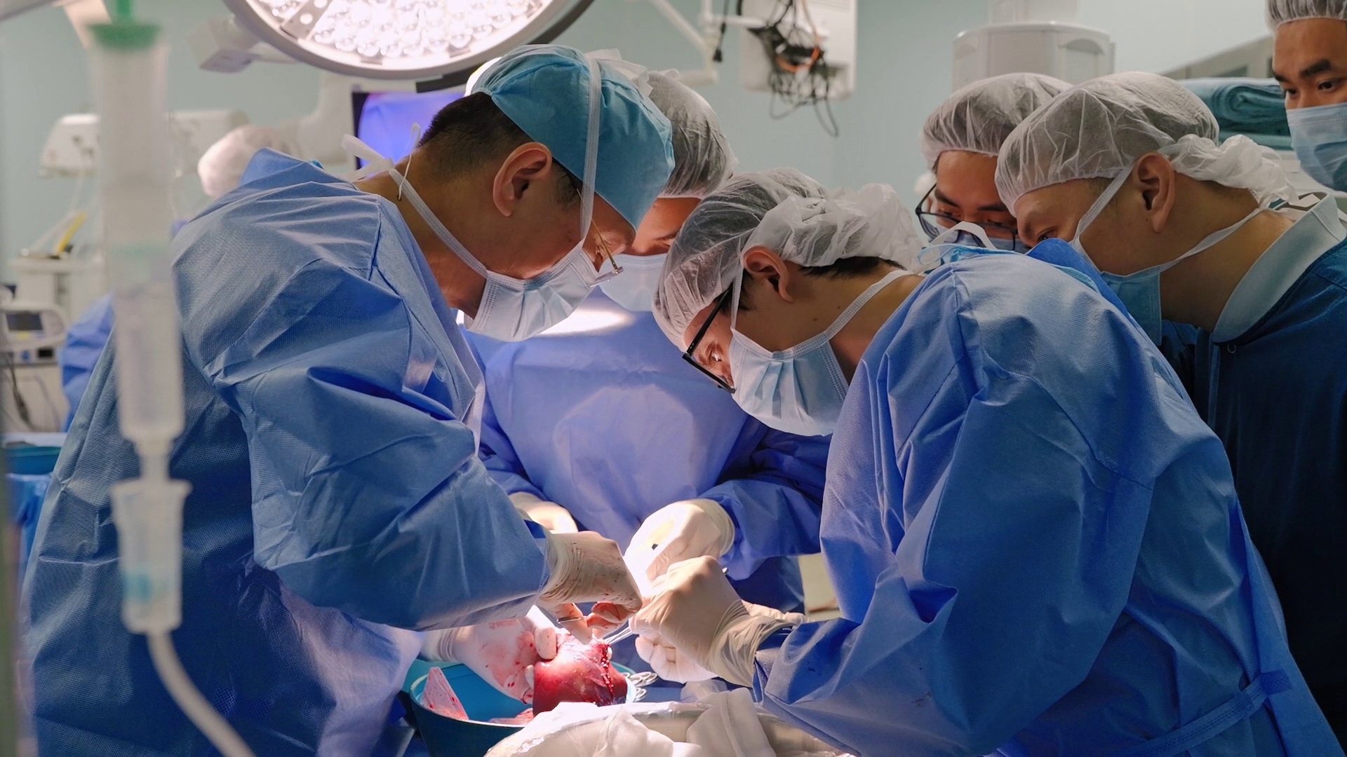 PGS.TS.BS L&ecirc; Văn Th&agrave;nh thực hiện lấy mảnh gh&eacute;p gan th&ugrave;y tr&aacute;i bằng kỹ thuật nội soi.