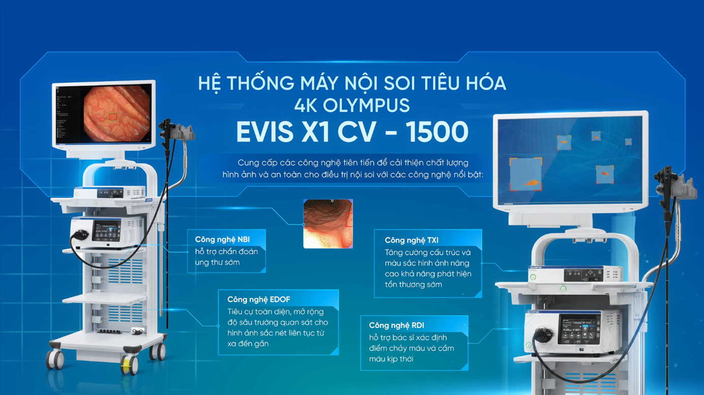Hệ thống nội soi ti&ecirc;u h&oacute;a Olympus EVIS X1 CV-1500 hiện đại