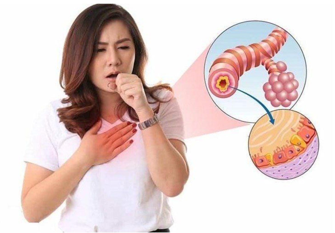 Vi&ecirc;m phổi mạn t&iacute;nh c&oacute; thể do nhiễm tr&ugrave;ng đường h&ocirc; hấp t&aacute;i đi t&aacute;i lại nhiều lần