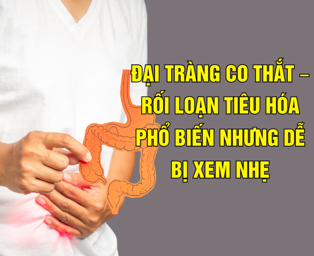 Đại tràng co thắt - rối loạn tiêu hóa phổ biến nhưng dễ bị xem nhẹ