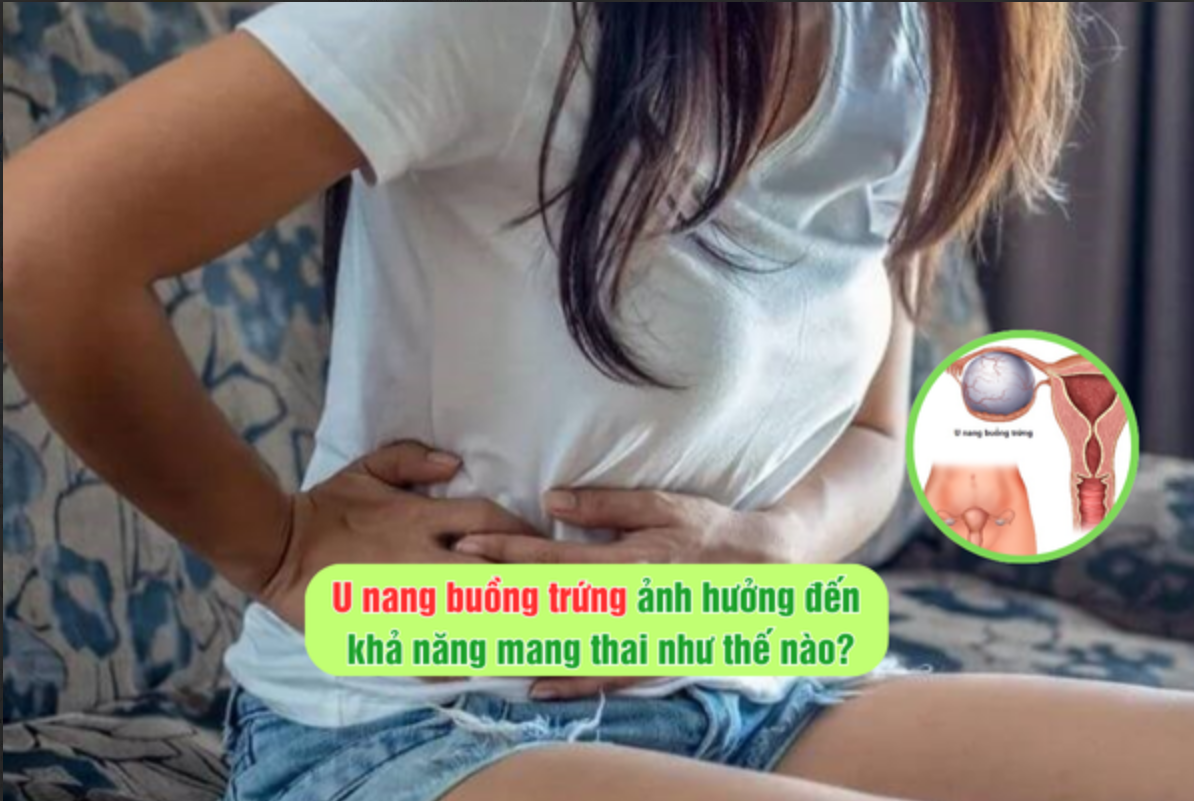 U nang buồng trứng ảnh hưởng đến khả năng mang thai như thế nào?
