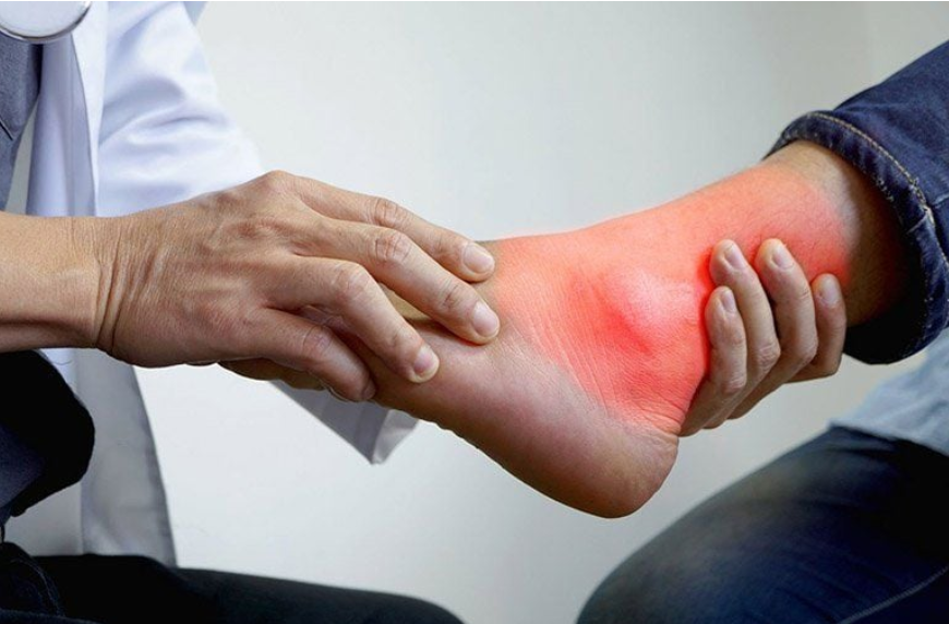 Kiểm soát bệnh gút sẽ giúp phòng ngừa biến chứng xương khớp về sau Kiểm soát bệnh gút sẽ giúp phòng ngừa biến chứng xương khớp về sau